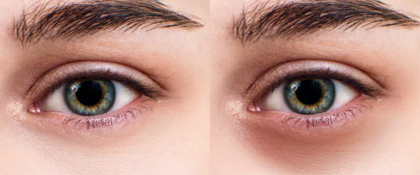Talcum powder sales in eyes